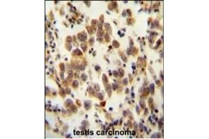 Immunohistochemistry (Paraffin-embedded Sections) (IHC (p)) image for anti-Olfactory Receptor, Family 8, Subfamily B, Member 8 (OR8B8) (AA 280-308), (C-Term) antibody (ABIN654816)