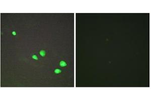 Immunofluorescence analysis of HepG2 cells, using CHD4 antibody. (CHD4 抗体  (Internal Region))
