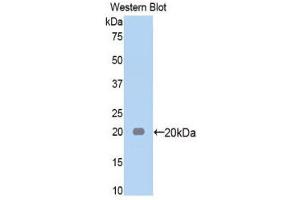 Western Blotting (WB) image for anti-alpha-2-Macroglobulin (A2M) (AA 574-734) antibody (ABIN1857847) (alpha 2 Macroglobulin 抗体  (AA 574-734))