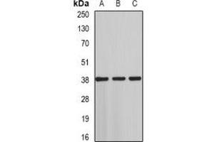 Western blot analysis of ST3GAL4 expression in HT29 (A), rat testis (B), rat liver (C) whole cell lysates. (ST3GAL4 抗体)