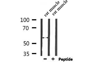 Western blot analysis of extracts from rat muscle, using ENDOD1 Antibody. (ENDOD1 抗体  (Internal Region))