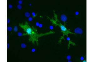 Rat brain neural cultures stained with (green) and DNA (blue). (Galectin 3 抗体)