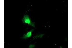 Anti-EXOSC7 mouse monoclonal antibody (ABIN2455516) immunofluorescent staining of COS7 cells transiently transfected by pCMV6-ENTRY EXOSC7 (RC201419). (EXOSC7 抗体)