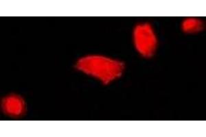 Immunofluorescent analysis of DCAF7 staining in U2OS cells. (DCAF7 抗体)