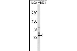 SCNN1D Antibody (N-term) (ABIN1539104 and ABIN2849251) western blot analysis in MDA-M cell line lysates (35 μg/lane). (SCNN1D 抗体  (N-Term))