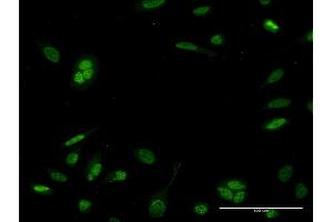Immunofluorescence of monoclonal antibody to NEUROD6 on HeLa cell. (NEUROD6 抗体  (AA 191-290))