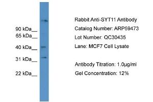 WB Suggested Anti-SYT11  Antibody Titration: 0. (SYT11 抗体  (N-Term))