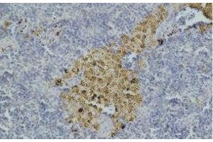Immunohistochemistry of paraffin-embedded Mouse spleen tissue with CASP8 Monoclonal Antibody (Caspase 8 抗体)