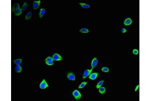 Immunofluorescent analysis of A375 cells using ABIN7146996 at dilution of 1:100 and Alexa Fluor 488-congugated AffiniPure Goat Anti-Rabbit IgG(H+L) (Cathepsin B 抗体  (AA 82-333))