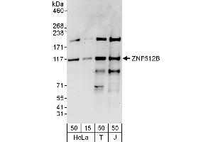 anti-Zinc Finger Protein 512B (ZNF512B) (AA 650-700) antibody