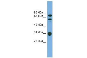 SH3KBP1 antibody used at 1 ug/ml to detect target protein.