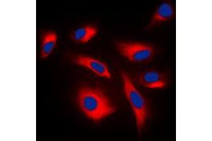 Immunofluorescent analysis of MKK1/2 (pS222/226) staining in K562 cells.