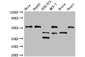 Western Blot Positive WB detected in: Hela whole cell lysate, HepG2 whole cell lysate, NIH/3T3 whole cell lysate, MCF-7 whole cell lysate, Mouse brain tissue, Rat heart tissue All lanes: LAX1 antibody at 2. (LAX1 抗体  (AA 107-298))