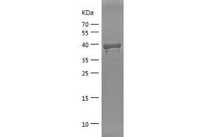Western Blotting (WB) image for Eukaryotic Translation Initiation Factor 2A, 65kDa (EIF2A) (AA 432-585) protein (His-IF2DI Tag) (ABIN7122840)