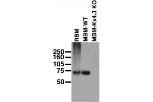 Immunoblot on adult rat brain membranes (RBM), and adult mouse brain membranes from wild-type (MBM-WT) and Kv4.