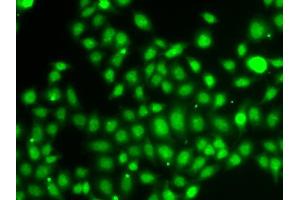 Immunofluorescence analysis of A549 cells using TXNL4B antibody (ABIN5974279). (TXNL4B 抗体)