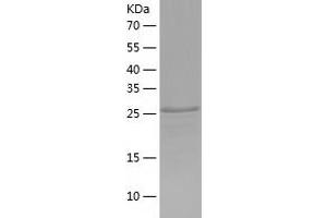 Western Blotting (WB) image for Fc Receptor-Like 6 (FCRL6) (AA 20-307) protein (His tag) (ABIN7287603) (FCRL6 Protein (AA 20-307) (His tag))