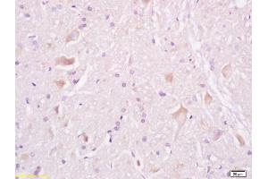 Formalin-fixed and paraffin embedded rat brain tissue labeled withAnti-Tuberin/TSC2 Polyclonal Antibody, Unconjugated (ABIN701200) at 1:200, followed by conjugation to the secondary antibody and DAB staining (Tuberin 抗体  (AA 1601-1750))