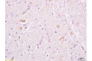 Formalin-fixed and paraffin embedded rat brain tissue labeled withAnti-Tuberin/TSC2 Polyclonal Antibody, Unconjugated (ABIN701200) at 1:200, followed by conjugation to the secondary antibody and DAB staining (Tuberin 抗体  (AA 1601-1750))