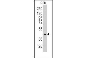 Image no. 1 for anti-Aldolase C, Fructose-Bisphosphate (ALDOC) (C-Term) antibody (ABIN357882) (ALDOC 抗体  (C-Term))