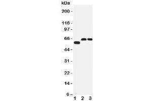 Western blot testing of SLC1A4 antibody and Lane 1:  human U87;  2: rat brain;  3: mouse brain tissue lysate. (SLC1A4 抗体  (C-Term))