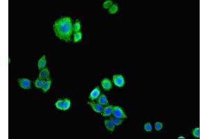 Immunofluorescent analysis of PC-3 cells cells using ABIN7146207 at dilution of 1:100 and Alexa Fluor 488-congugated AffiniPure Goat Anti-Rabbit IgG(H+L) (Cadherin 12 抗体  (AA 56-605))