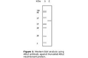 Image no. 1 for anti-ABL2 (ABL2) antibody (ABIN230671) (ABL2 抗体)