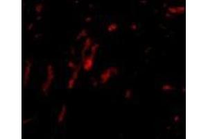 Immunocytochemistry of PARL in 3T3 cells with this product at 2. (PARL 抗体  (N-Term))