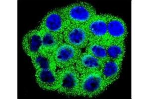 Confocal immunofluorescent analysis of CDKN2B antibody with HeLa cells followed by Alexa Fluor 488-conjugated goat anti-rabbit lgG (green).
