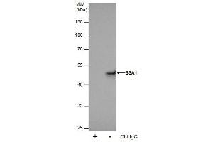 IP Image Immunoprecipitation of SSA1 protein from 293T whole cell extracts using 5 μg of SSA1 antibody [C1C3], Western blot analysis was performed using SSA1 antibody [C1C3], EasyBlot anti-Rabbit IgG  was used as a secondary reagent. (TRIM21 抗体)