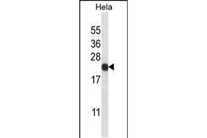 Western blot analysis in Hela cell line lysates (35ug/lane).
