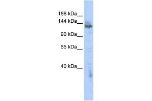 WB Suggested Anti-ZMYND8 Antibody Titration:  0. (ZMYND8 抗体  (Middle Region))