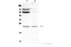 Western blot analysis of LMO2 using anti-LMO2 antibody . (LMO2 抗体)