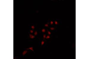 ABIN6269348 staining Jurkat cells by IF/ICC. (BIK 抗体)