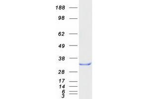 Western Blotting (WB) image for RAN Binding Protein 1 (RANBP1) protein (Myc-DYKDDDDK Tag) (ABIN2730450)