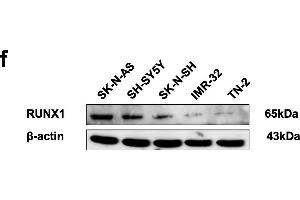Identification of RUNX1 as an apoptosis transcription factor and an independent prognostic factor in NB tissue and cell lines.