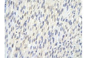 Rabbit Anti-SAP30BP antibody        Paraffin Embedded Tissue:  Human Heart cell   Cellular Data:  Epithelial cells of renal tubule  Antibody Concentration:   4. (SAP30BP 抗体  (N-Term))