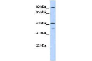 WB Suggested Anti-OAS1 Antibody Titration:  0. (OAS1 抗体  (Middle Region))