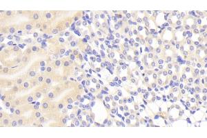 Immunohistochemistry (IHC) image for anti-alpha-1-B Glycoprotein (A1BG) (AA 313-512) antibody (ABIN7437173)
