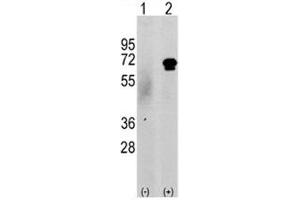 Western blot analysis of CAMKK2 antibody and 293 cell lysate either nontransfected (c) or transiently transfected with the CAMKK2 gene (2). (CAMKK2 抗体  (AA 52-82))