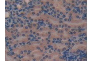 Immunohistochemistry (IHC) image for anti-Sclerostin Domain Containing 1 (SOSTDC1) (AA 24-206) antibody (ABIN7439462)