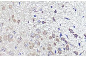 Immunohistochemistry of paraffin-embedded Mouse brain using UBL3 Polyclonal Antibody at dilution of 1:100 (40x lens). (UBL3 抗体)