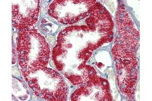 SH3BP2 antibody was used for immunohistochemistry at a concentration of 4-8 ug/ml. (SH3BP2 抗体  (Middle Region))