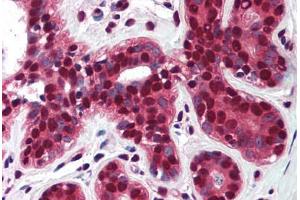 Human Breast (formalin-fixed, paraffin-embedded) stained with TP73 antibody ABIN290398 at 5 ug/ml followed by biotinylated goat anti-rabbit IgG secondary antibody ABIN481713, alkaline phosphatase-streptavidin and chromogen. (Tumor Protein p73 抗体  (AA 75-125))