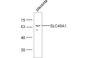Western Blotting (WB) image for anti-Solute Carrier Family 40 (Iron-Regulated Transporter), Member 1 (SLC40A1) (AA 331-430) antibody (ABIN1387819)