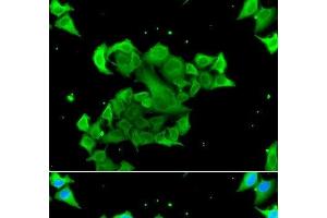 Immunofluorescence analysis of A549 cells using Rad51D Polyclonal Antibody (RAD51D 抗体)