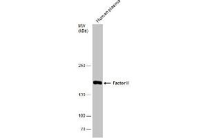 WB Image Human tissue extract (30 μg) was separated by 5% SDS-PAGE, and the membrane was blotted with Factor H antibody [N3C1], Internal , diluted at 1:500.