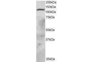 Image no. 1 for anti-Ring Finger Protein 31 (RNF31) (AA 908-921) antibody (ABIN297591) (RNF31 抗体  (AA 908-921))