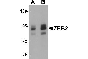 Western Blotting (WB) image for anti-Zinc Finger E-Box Binding Homeobox 2 (ZEB2) (C-Term) antibody (ABIN1030819) (ZEB2 抗体  (C-Term))