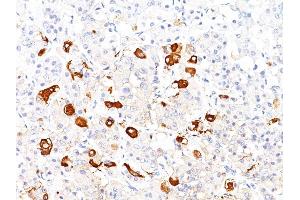 Formalin-fixed, paraffin-embedded human Pituitary stained with TSH beta Mouse Monoclonal Antibody (TSHb/1317). (TSHB 抗体)